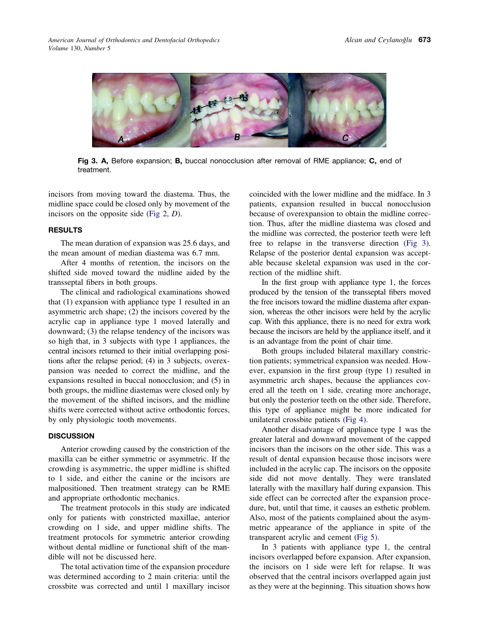 2006_130_5_671_675_Alcan.pdf_第3页