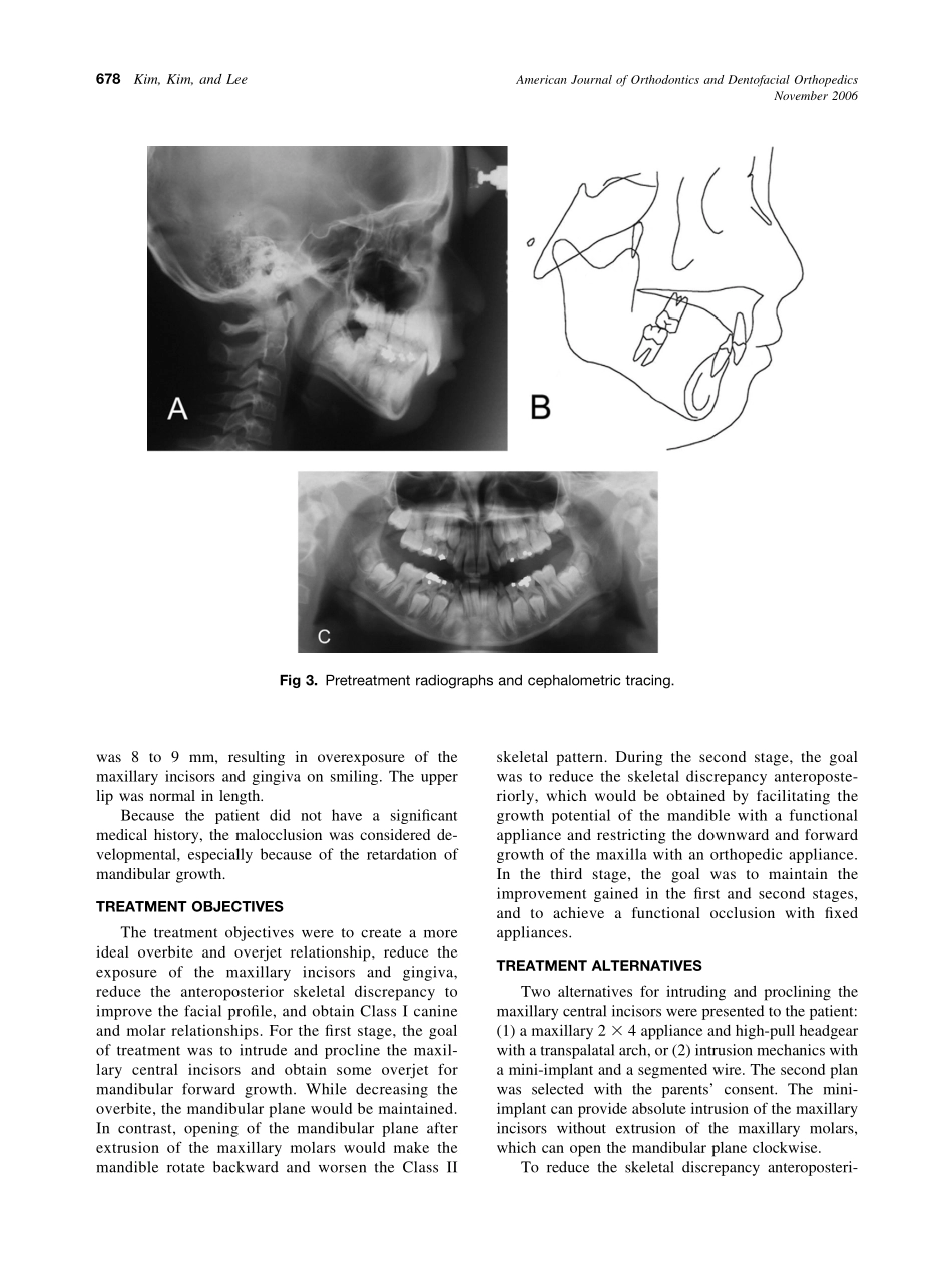 2006_130_5_676_685_Kim.pdf_第3页