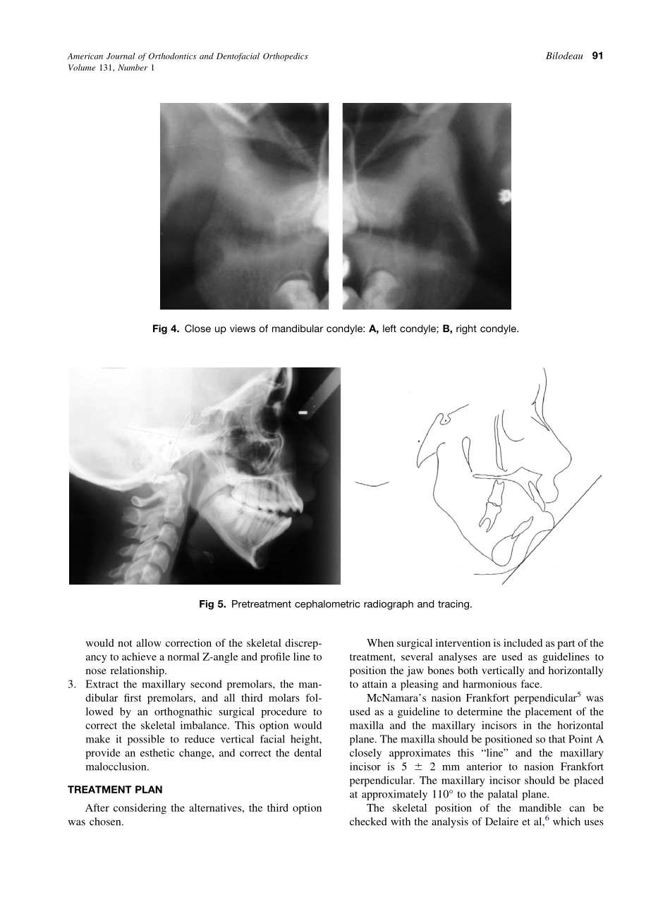 2007_131_1_89_97_Bilodeau.pdf_第3页