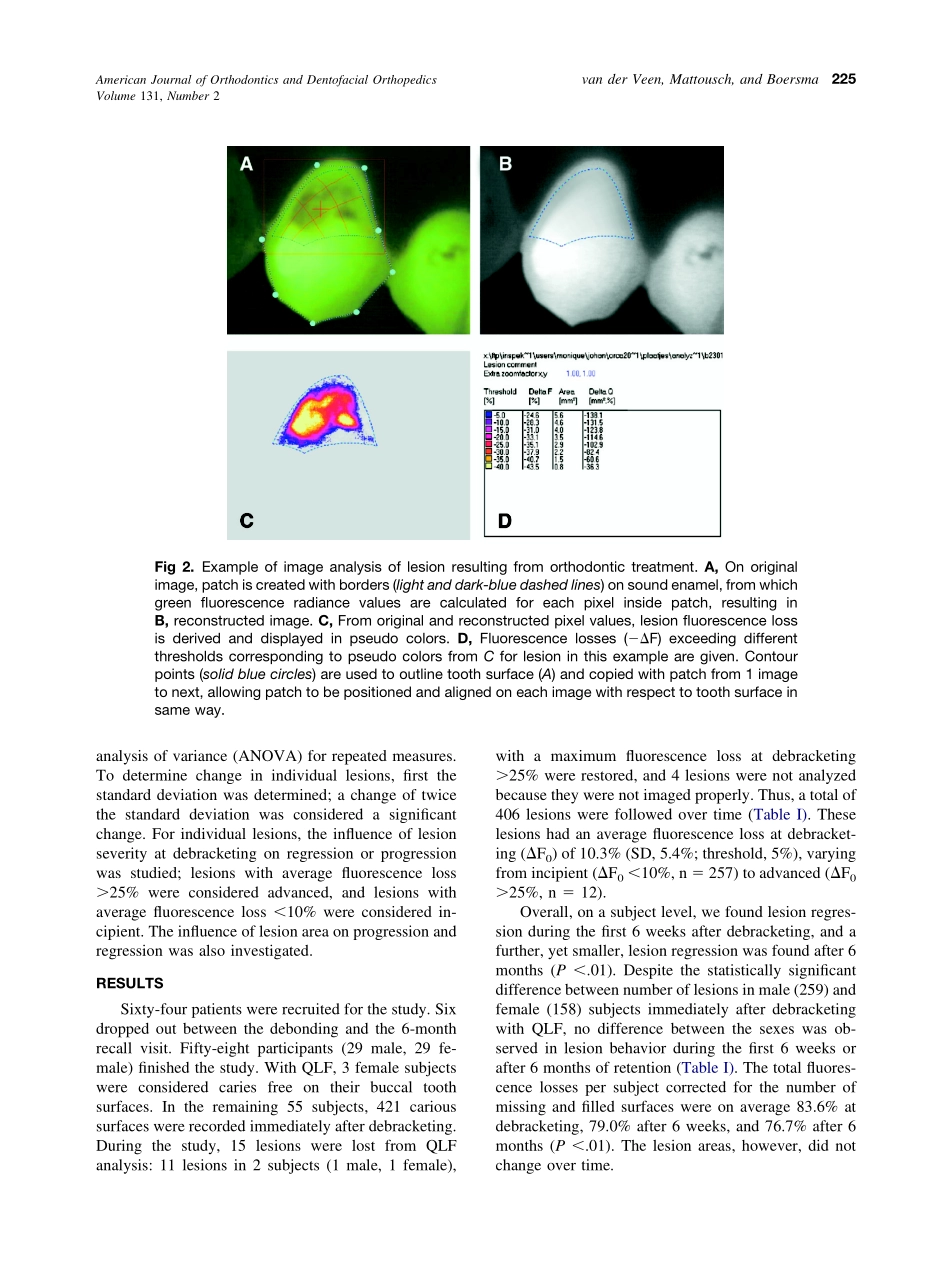 2007_131_2_223_228_van-der-Veen.pdf_第3页