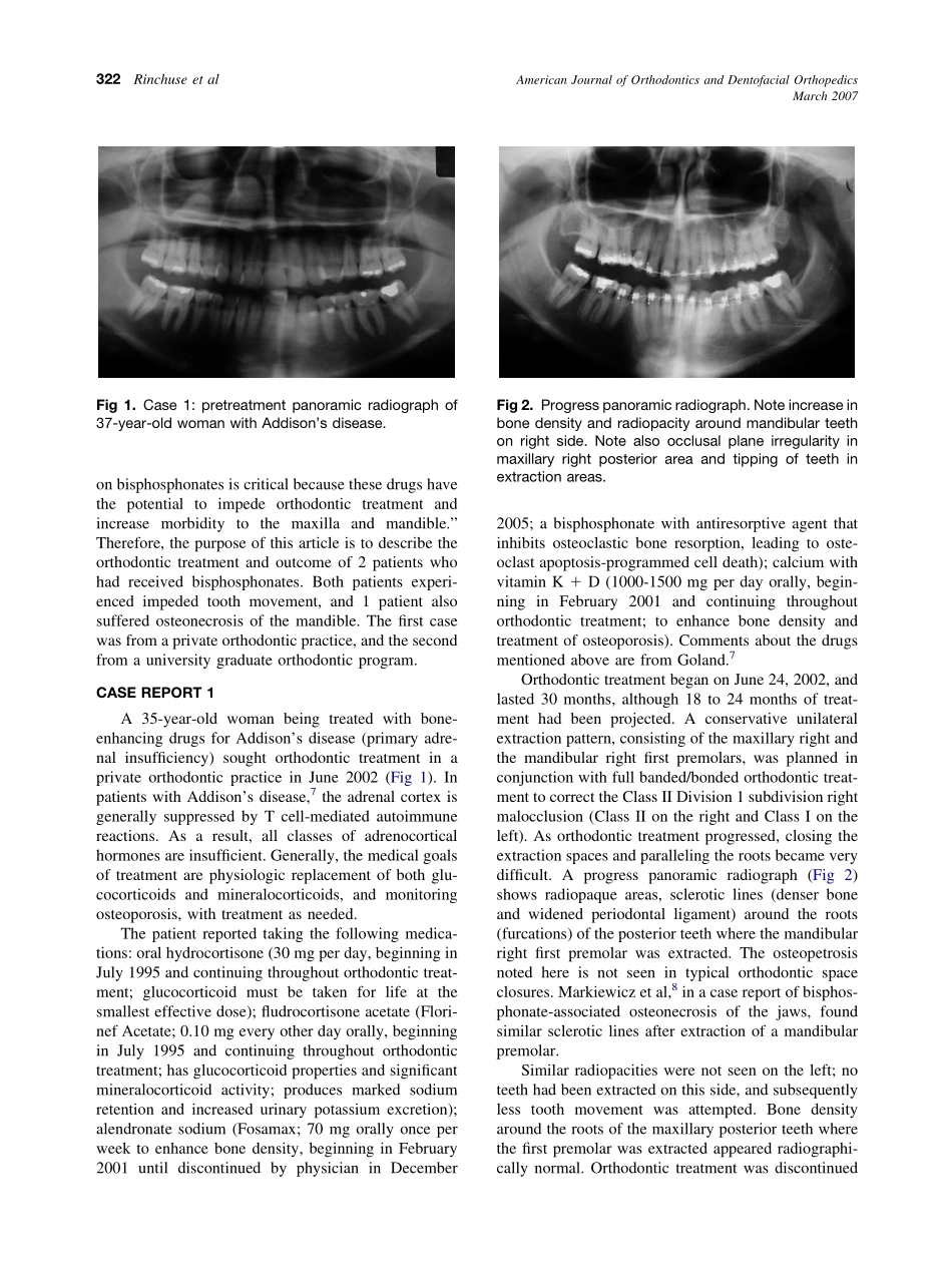 2007_131_3_321_326_Rinchuse.pdf_第2页