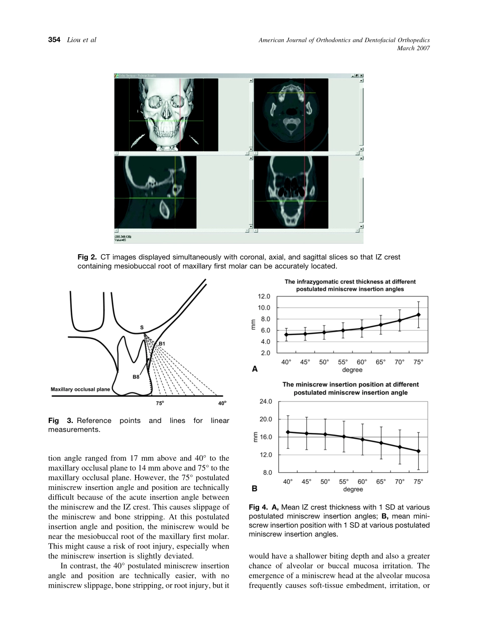 2007_131_3_352_356_Liou.pdf_第3页