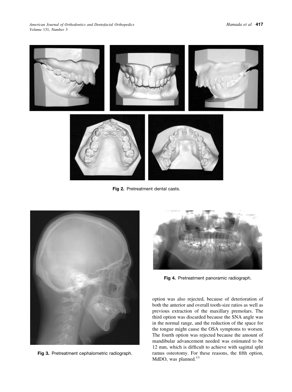 2007_131_3_415_425_Hamada.pdf_第3页