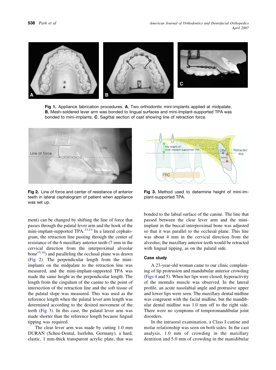 2007_131_4_537_544_Park.pdf_第2页