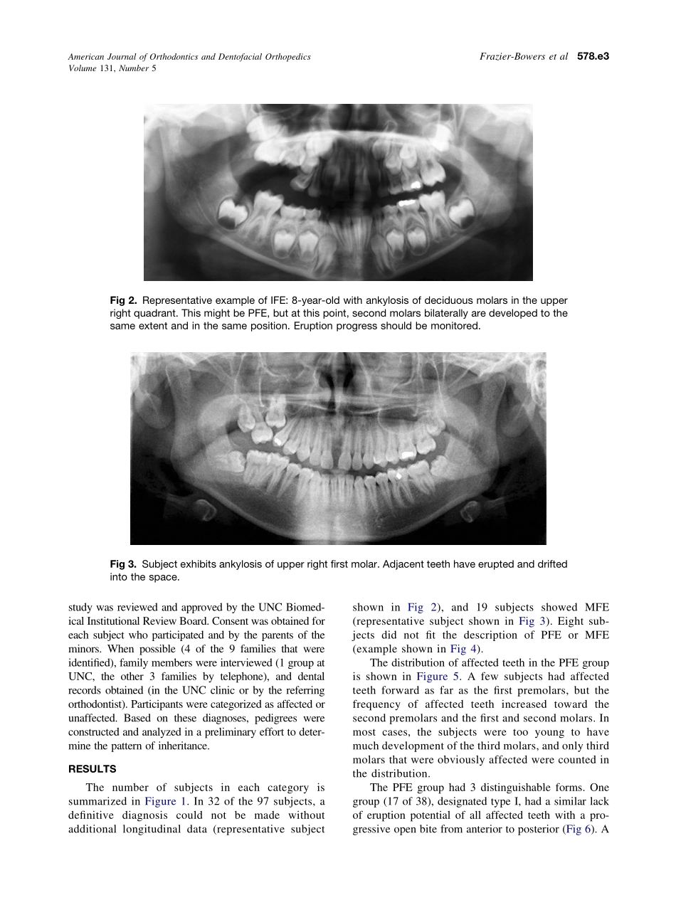 2007_131_5_578.e1_578.e11_Frazier-Bowers.pdf_第3页