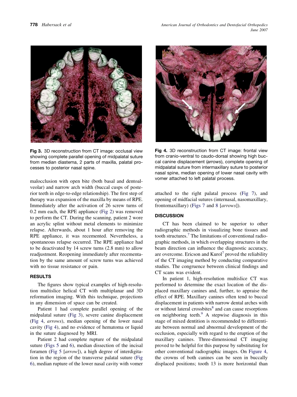 2007_131_6_776_781_Habersack.pdf_第3页