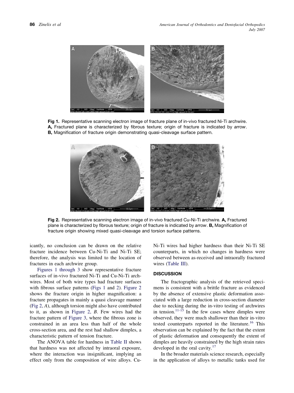 2007_132_1_84_89_Zinelis.pdf_第3页