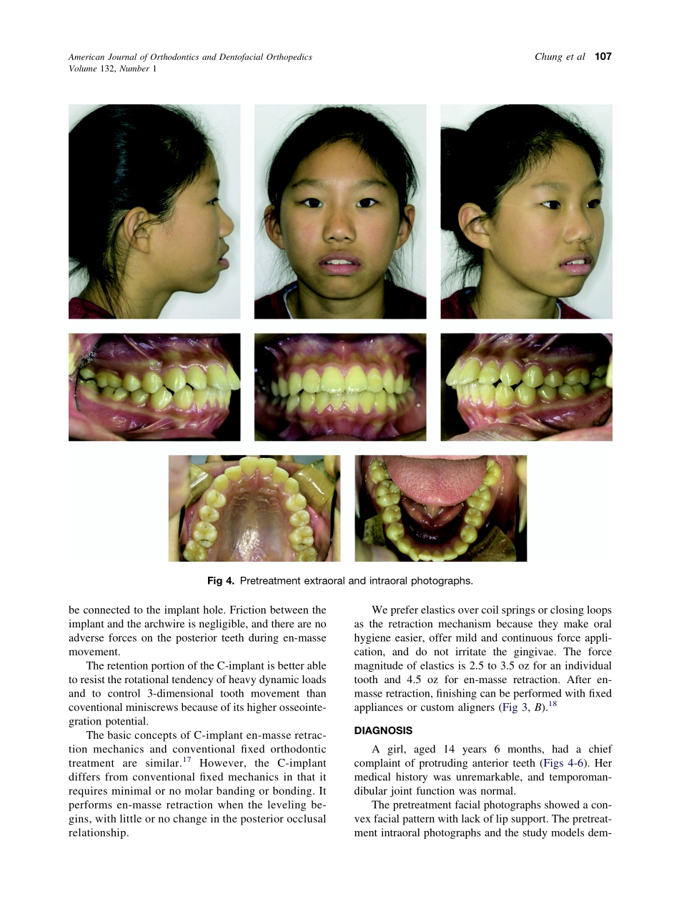 2007_132_1_105_115_Chung.pdf_第3页