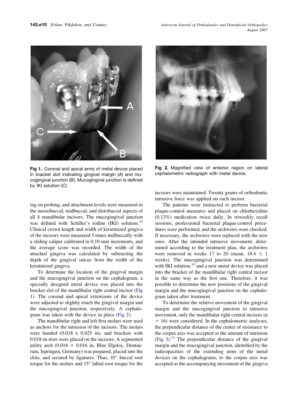 2007_132_2_143.e9_143.e13_Erkan.pdf_第2页