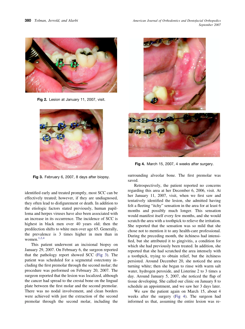 2007_132_3_378_381_Tolman.pdf_第3页