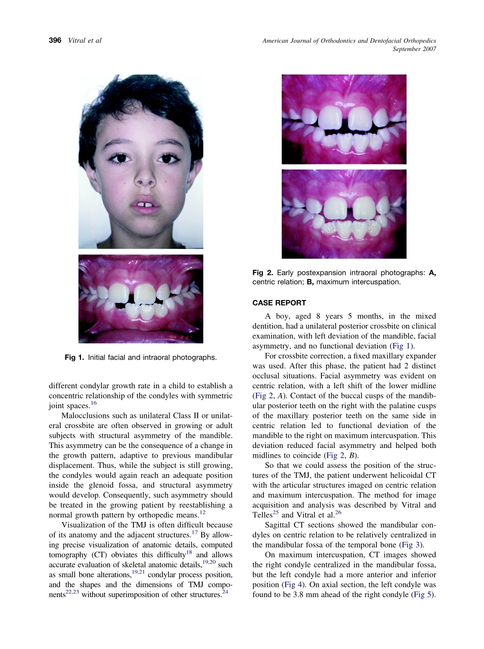 2007_132_3_395_399_Vitral.pdf_第2页