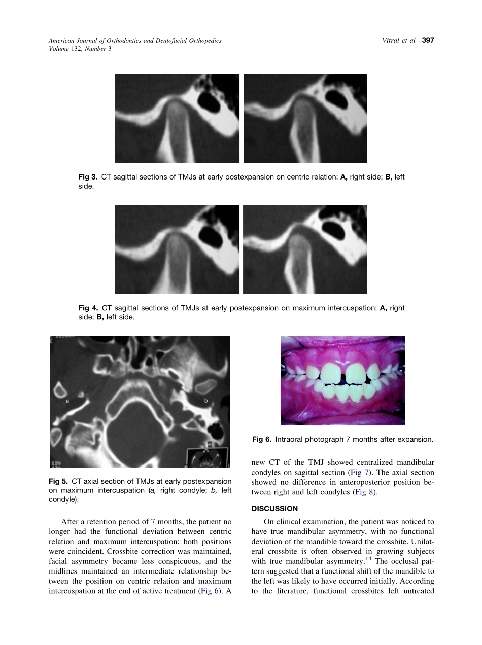 2007_132_3_395_399_Vitral.pdf_第3页