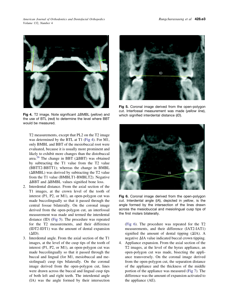 2007_132_4_428.e1_428.e8_Rungcharassaeng.pdf_第3页