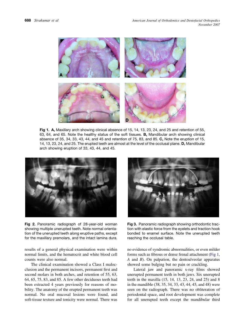 2007_132_5_687_692_Sivakumar.pdf_第2页