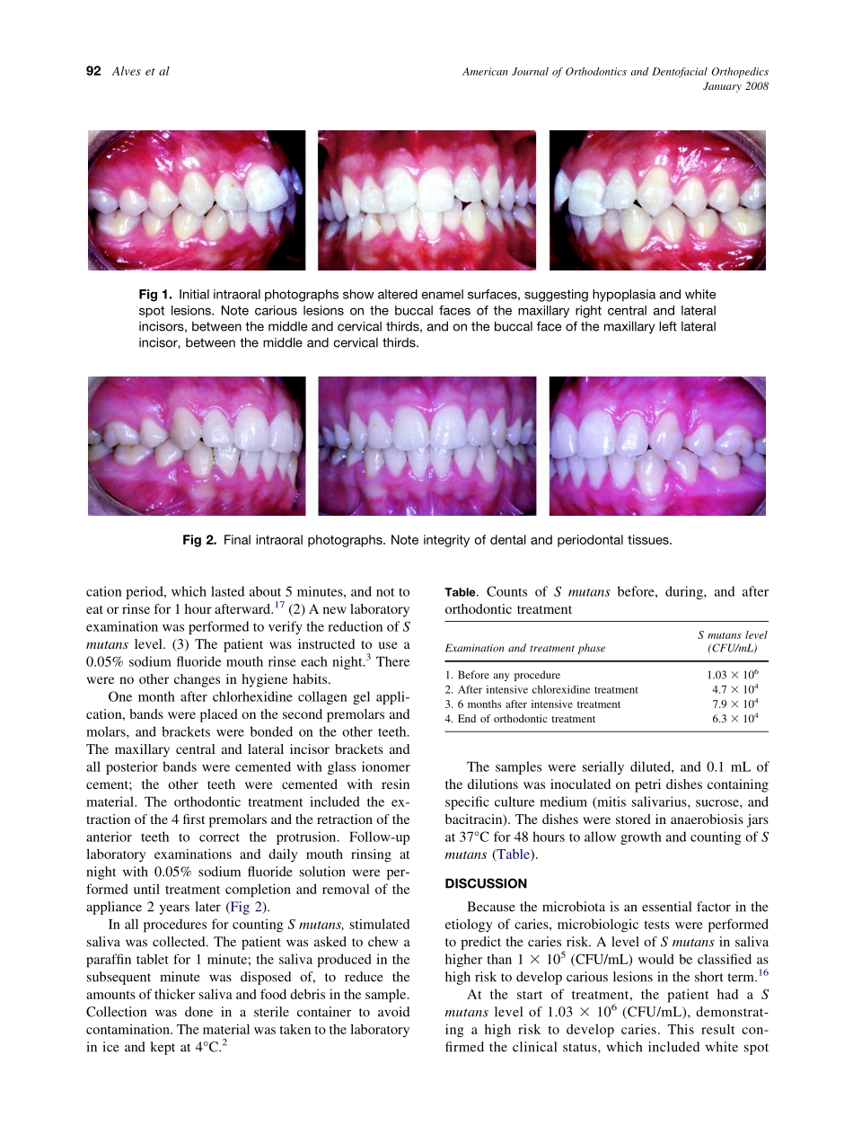 2008_133_1_91_94_Alves.pdf_第2页