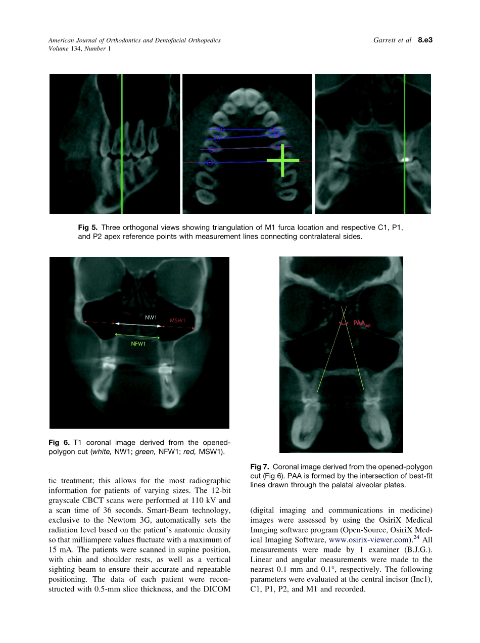 2008_134_1_8.e1_8.e11_Garrett.pdf_第3页