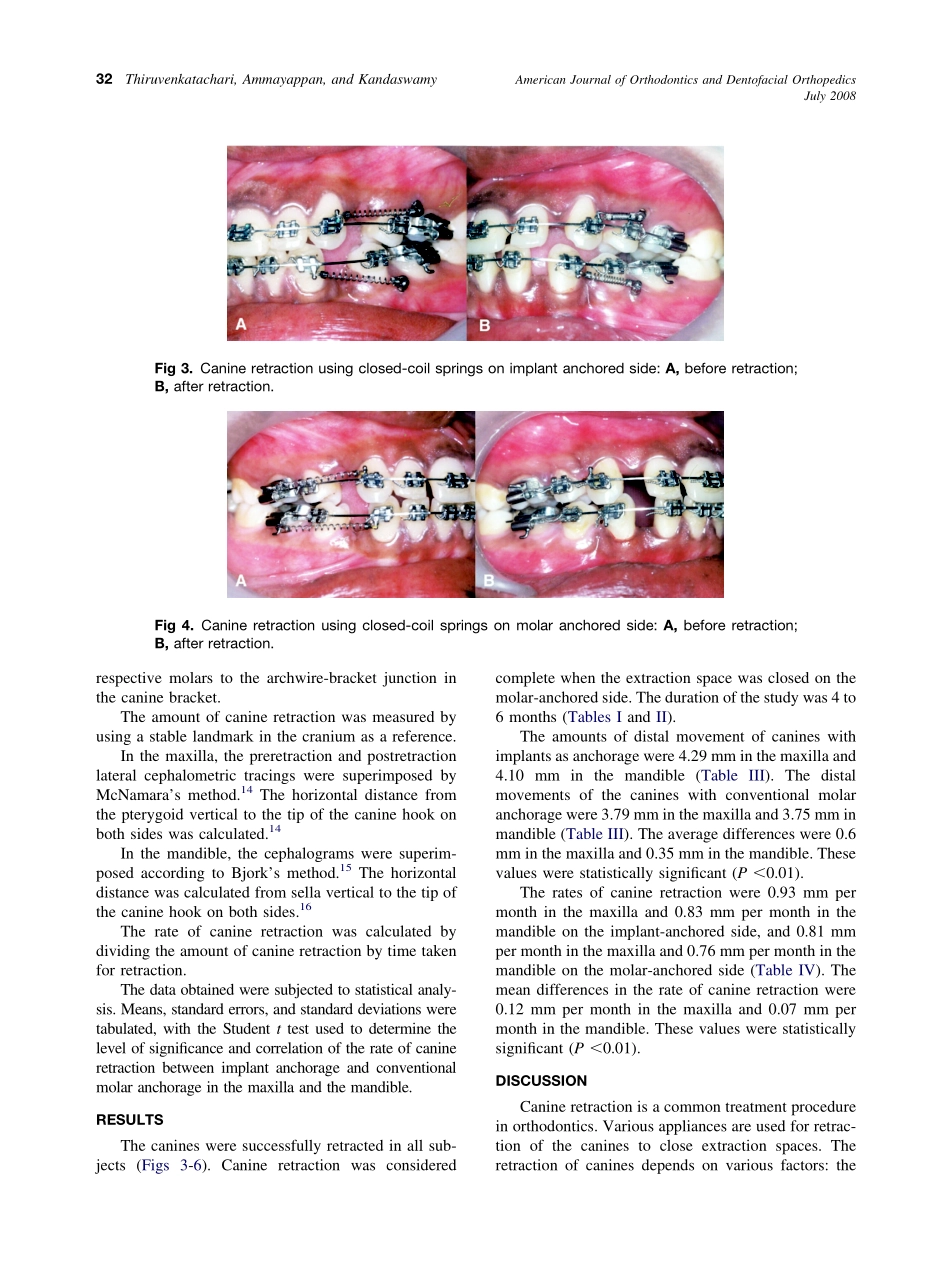 2008_134_1_30_35_Thiruvenkatachari.pdf_第3页