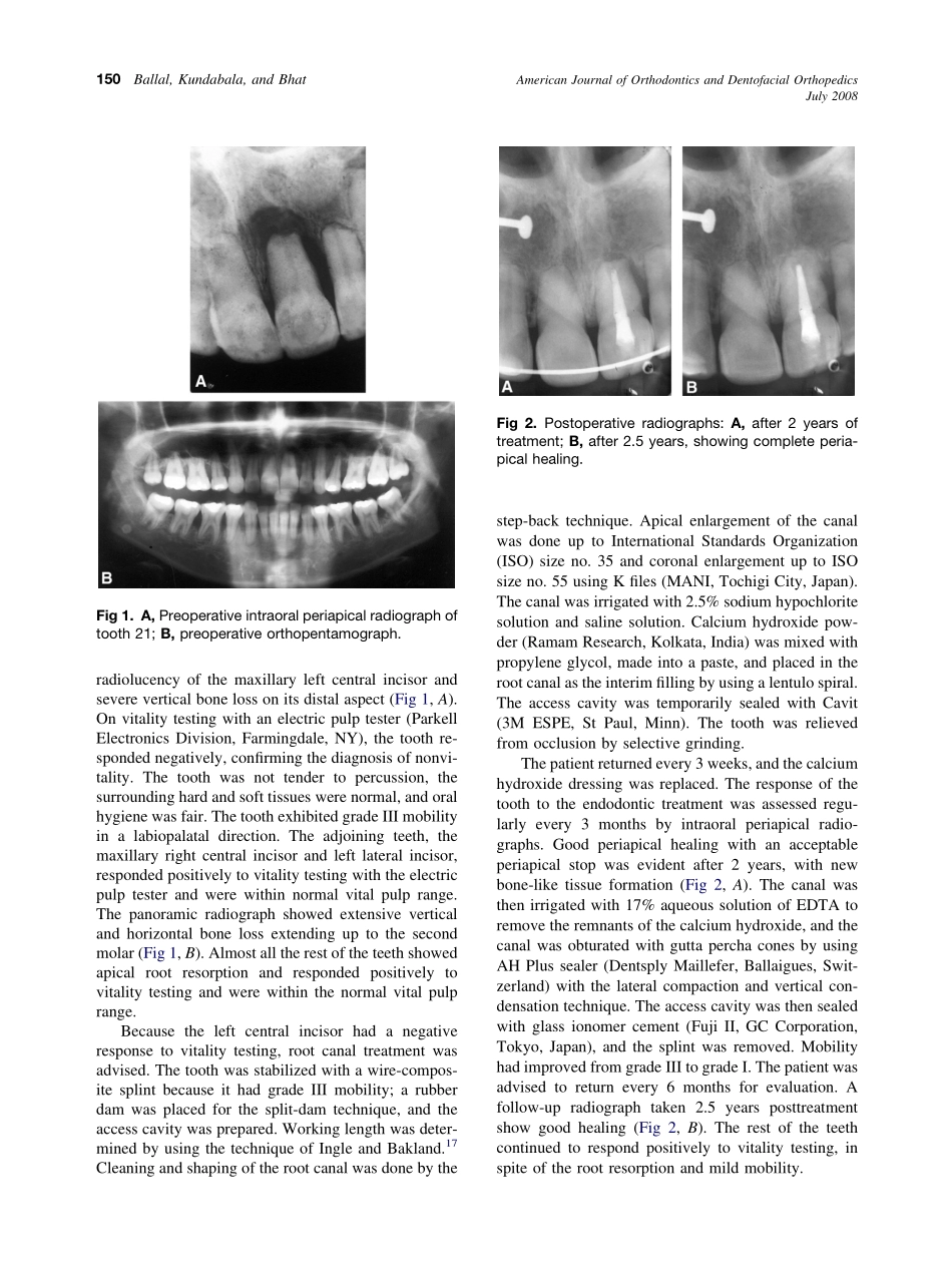 2008_134_1_149_152_Ballal.pdf_第2页