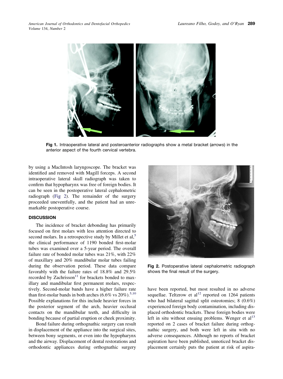 2008_134_2_288_290_Laureano-Filho.pdf_第2页