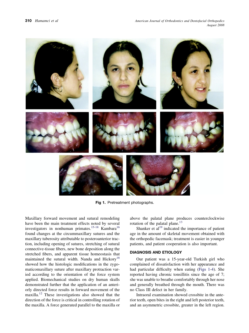 2008_134_2_309_317_Hamamci.pdf_第2页