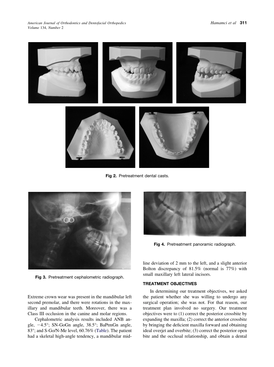 2008_134_2_309_317_Hamamci.pdf_第3页