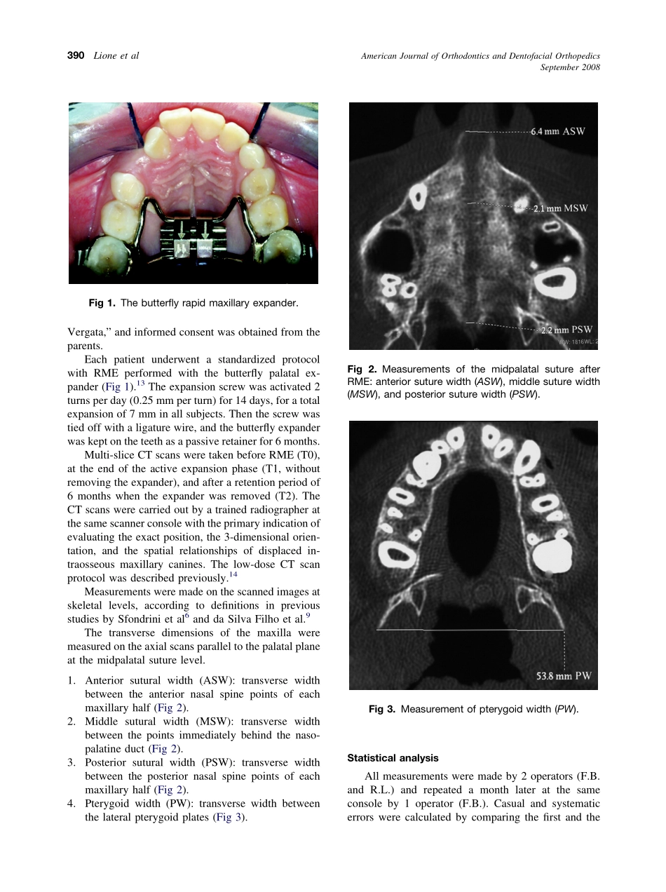 2008_134_3_389_392_Lione.pdf_第2页