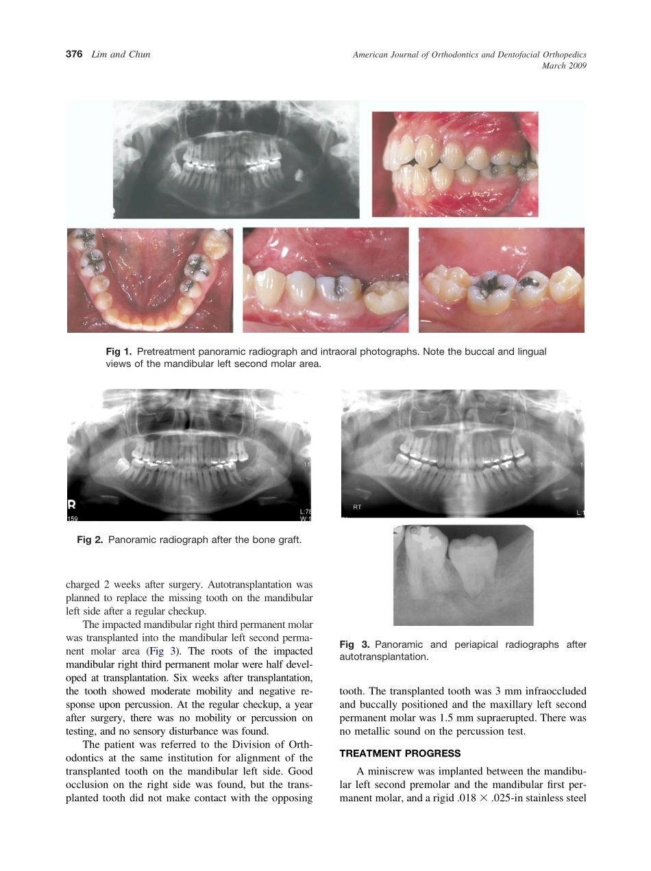 2009_135_3_375_379_Lim.pdf_第2页