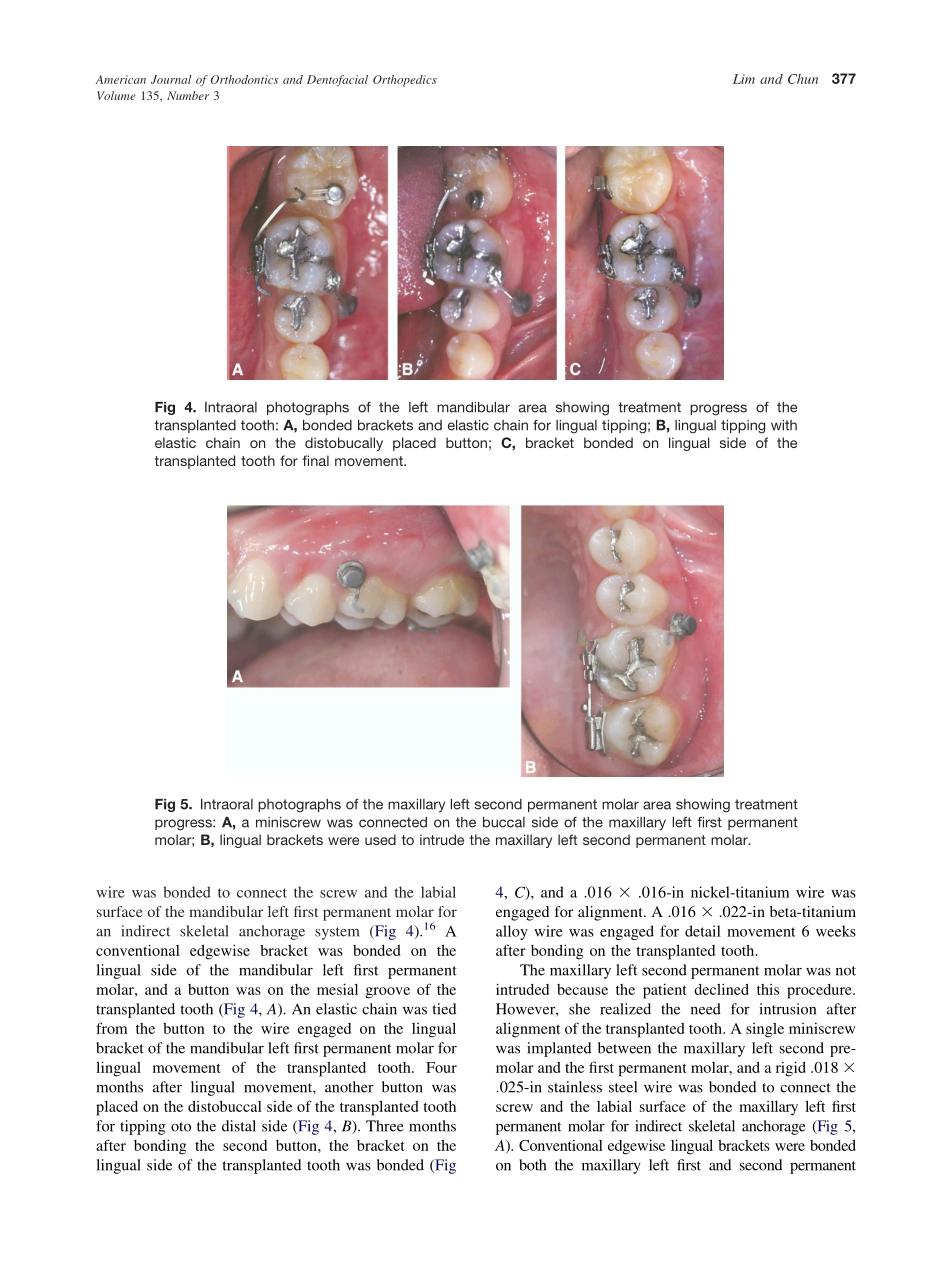 2009_135_3_375_379_Lim.pdf_第3页