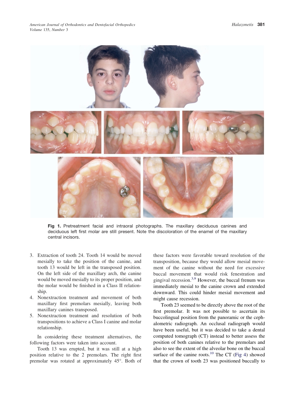 2009_135_3_380_389_Halazonetis.pdf_第2页