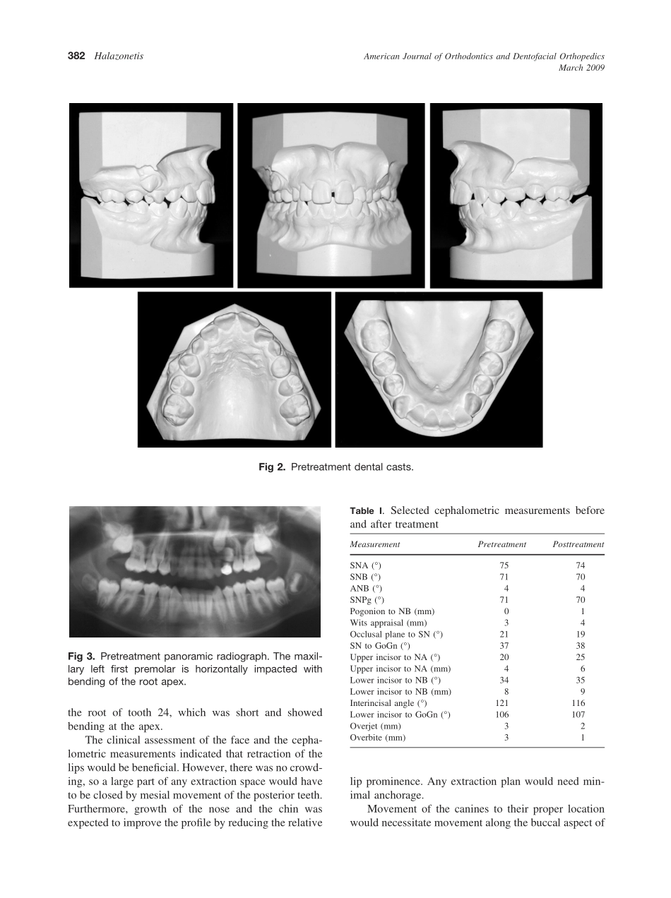 2009_135_3_380_389_Halazonetis.pdf_第3页