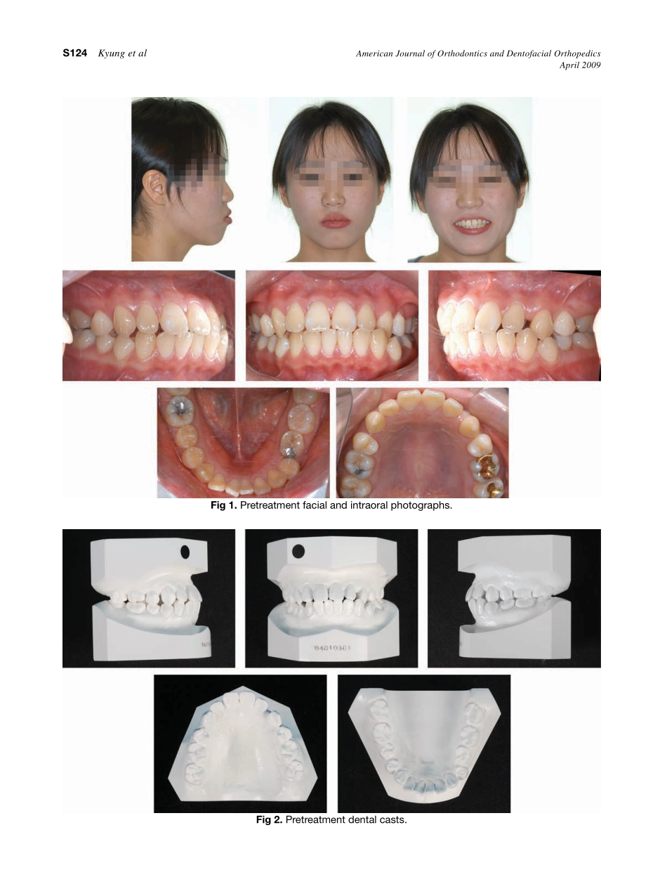 2009_135_4-Suppl-1_S123_S132_Kyung.pdf_第2页