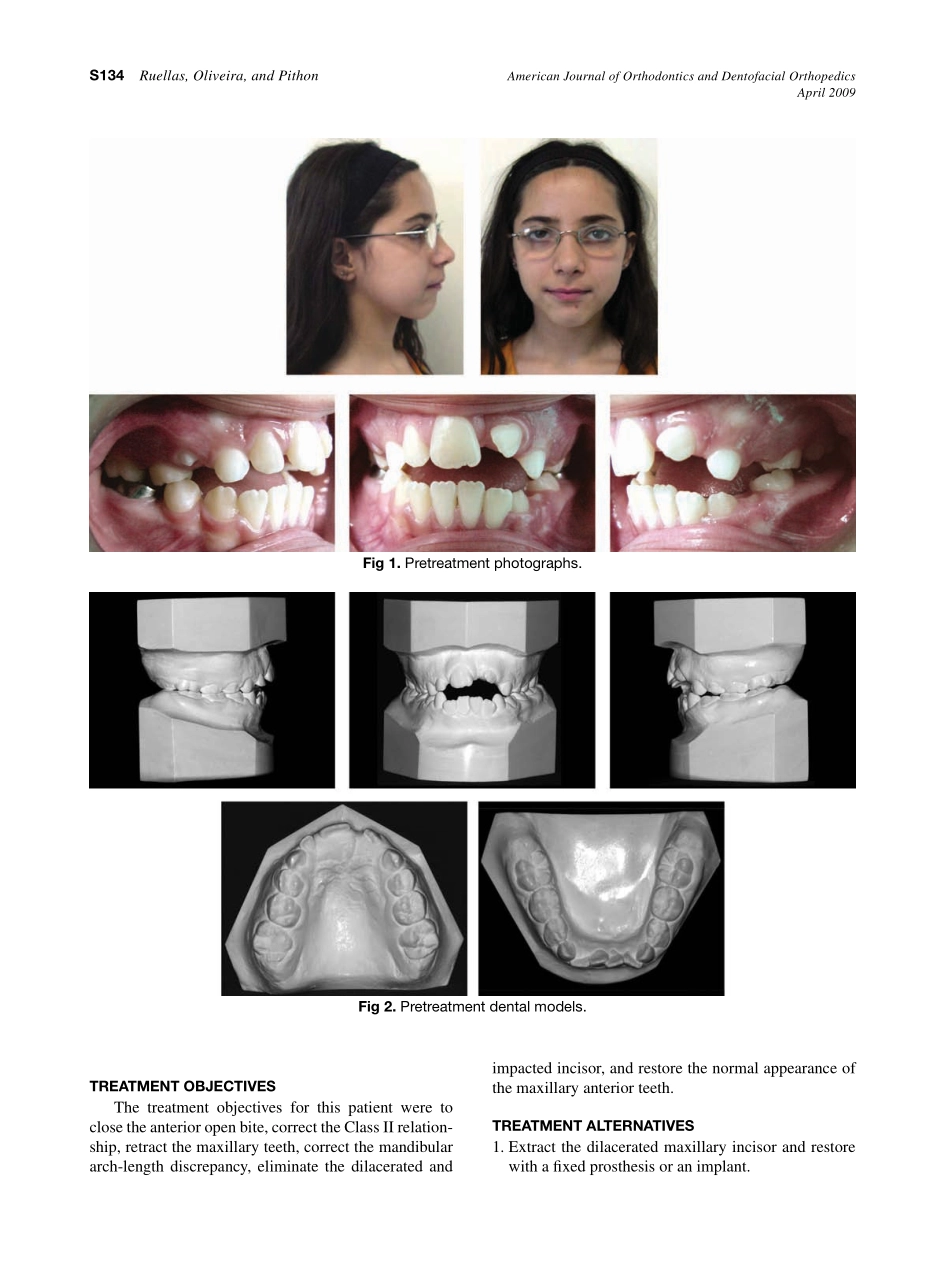 2009_135_4-Suppl-1_S133_S139_de-Oliveira-Ruellas.pdf_第2页