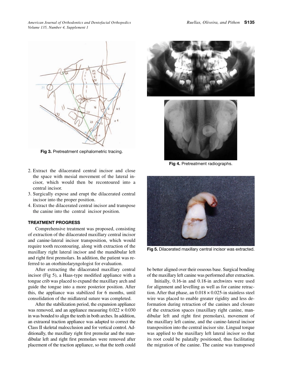 2009_135_4-Suppl-1_S133_S139_de-Oliveira-Ruellas.pdf_第3页