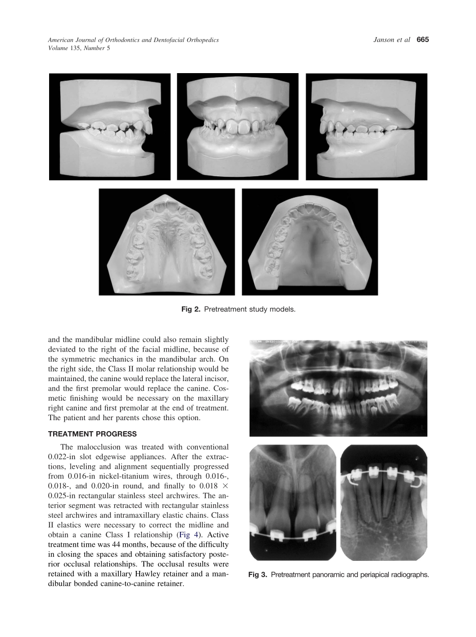 2009_135_5_663_670_Janson.pdf_第3页