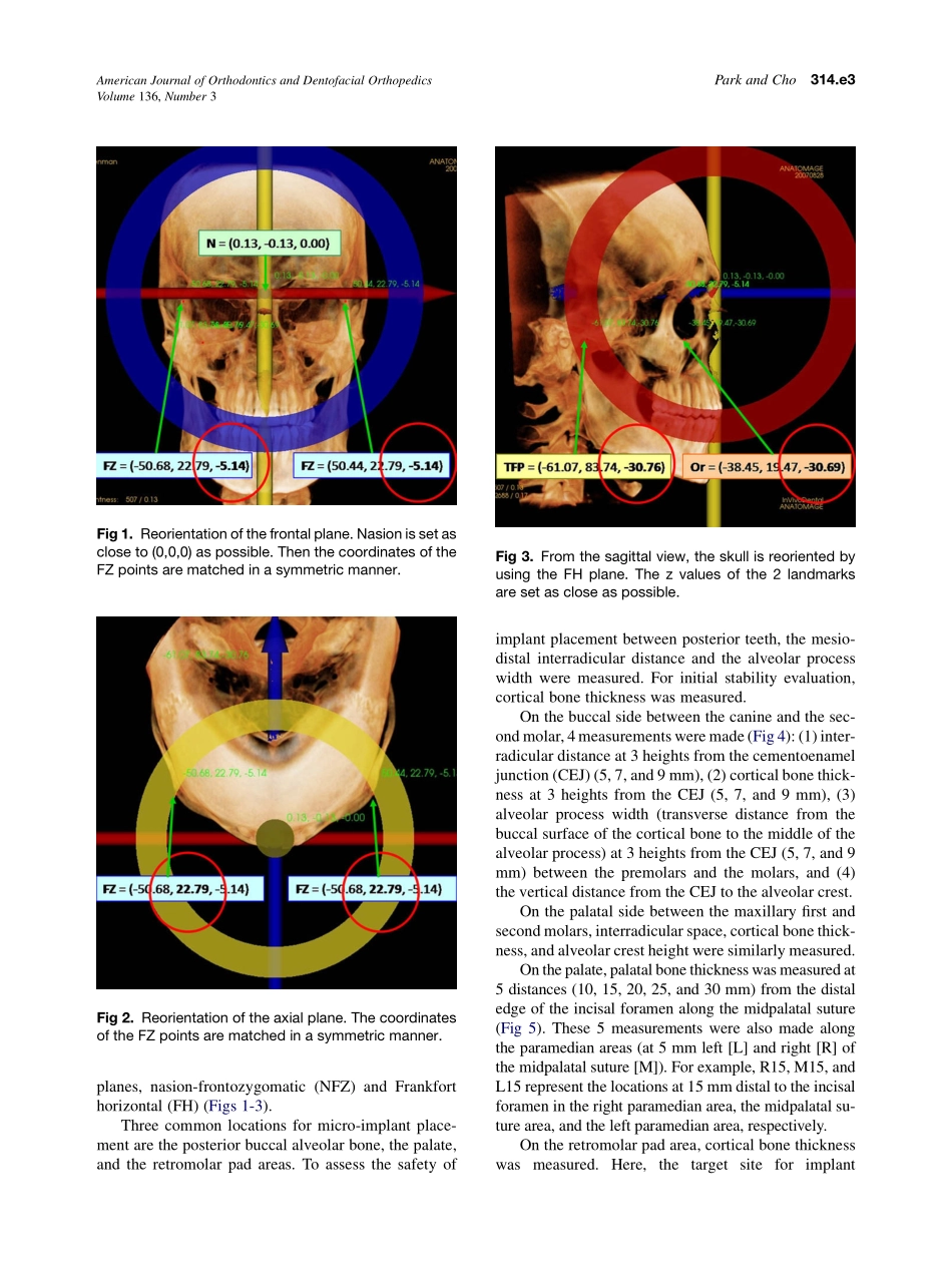 2009_136_3_314.e1_314.e12.pdf_第3页