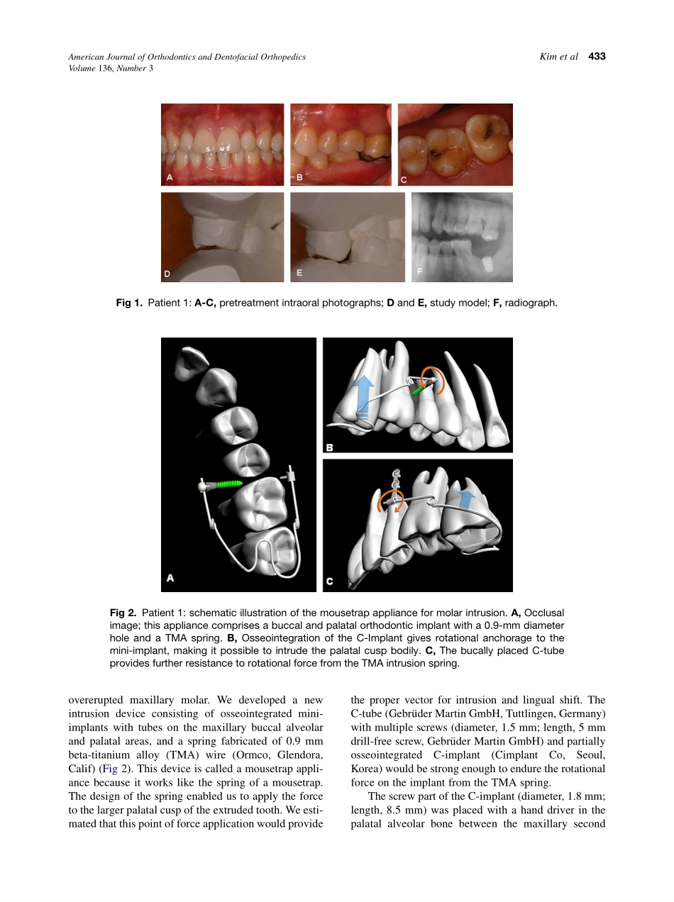 2009_136_3_431_439.pdf_第3页