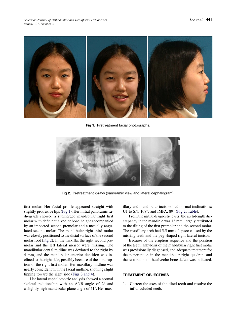 2009_136_3_440_449.pdf_第2页