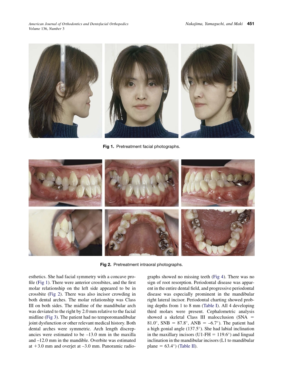 2009_136_3_450_459.pdf_第2页