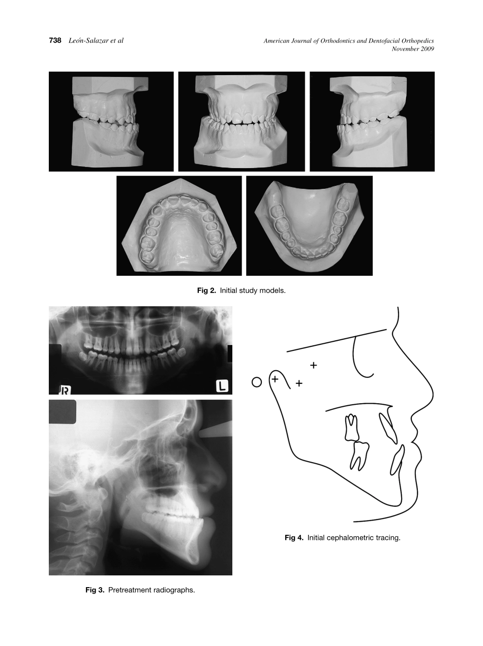 2009_136_5_736_745.pdf_第3页