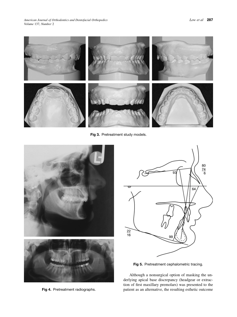 2010_137_2_285_292.pdf_第3页