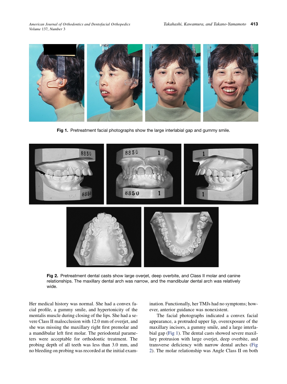 2010_137_3_412_423.pdf_第2页