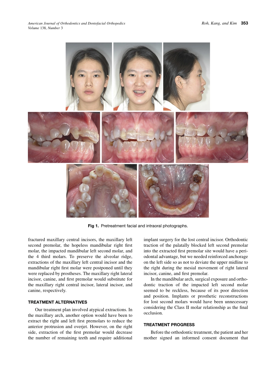 2010_138_3_352_360.pdf_第2页