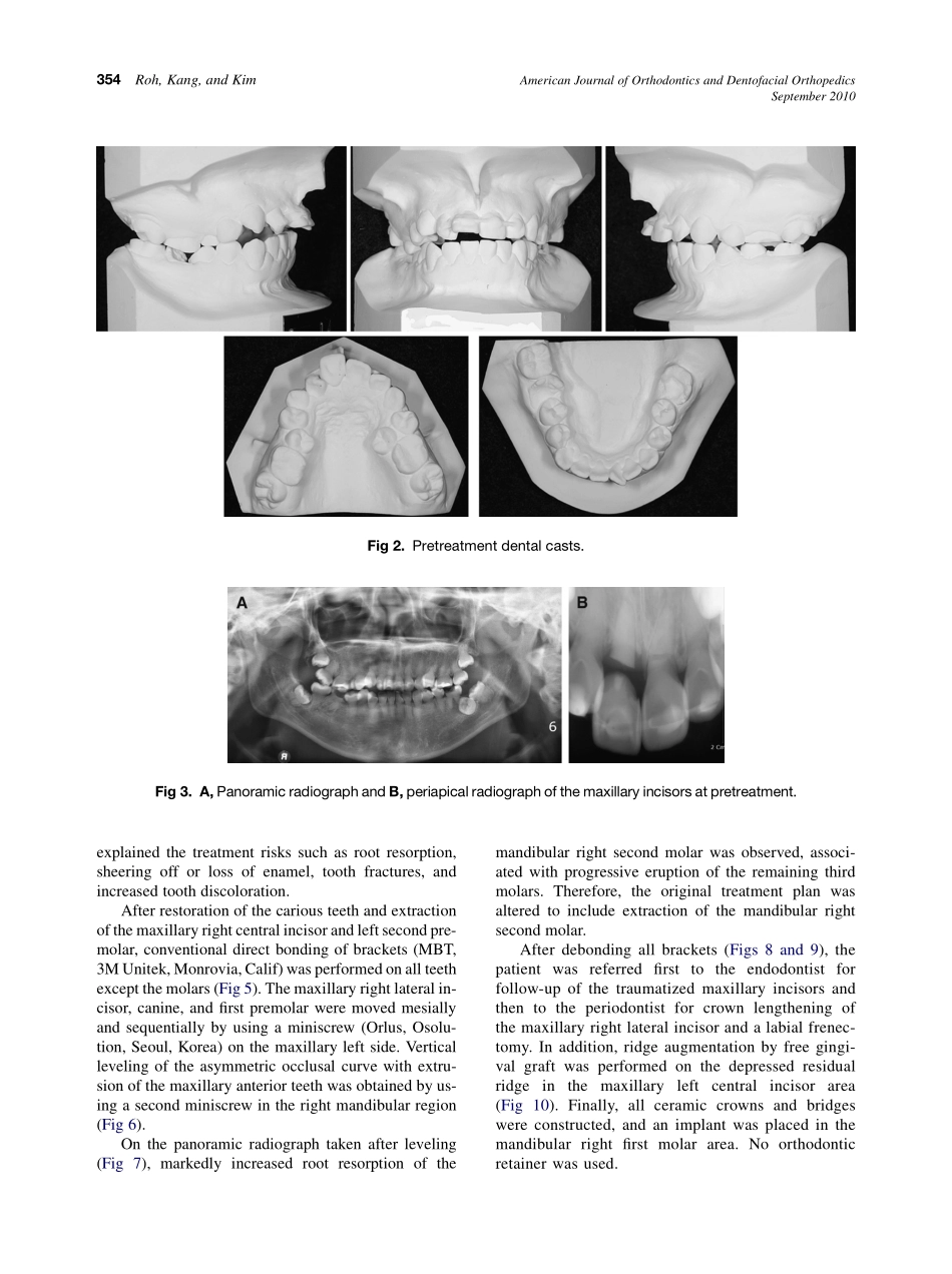 2010_138_3_352_360.pdf_第3页