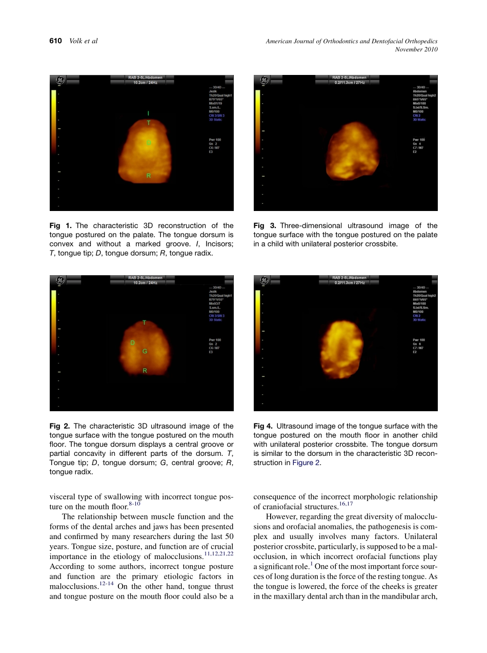 2010_138_5_608_612.pdf_第3页