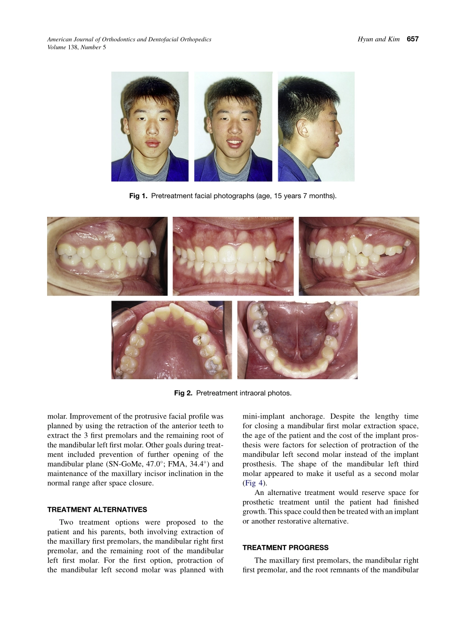 2010_138_5_656_665.pdf_第2页