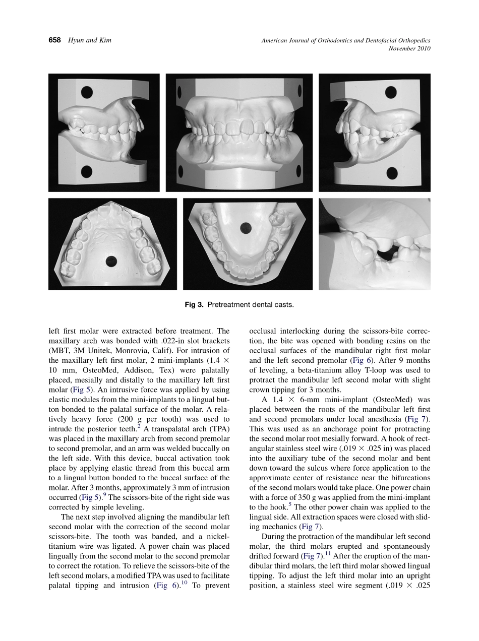 2010_138_5_656_665.pdf_第3页