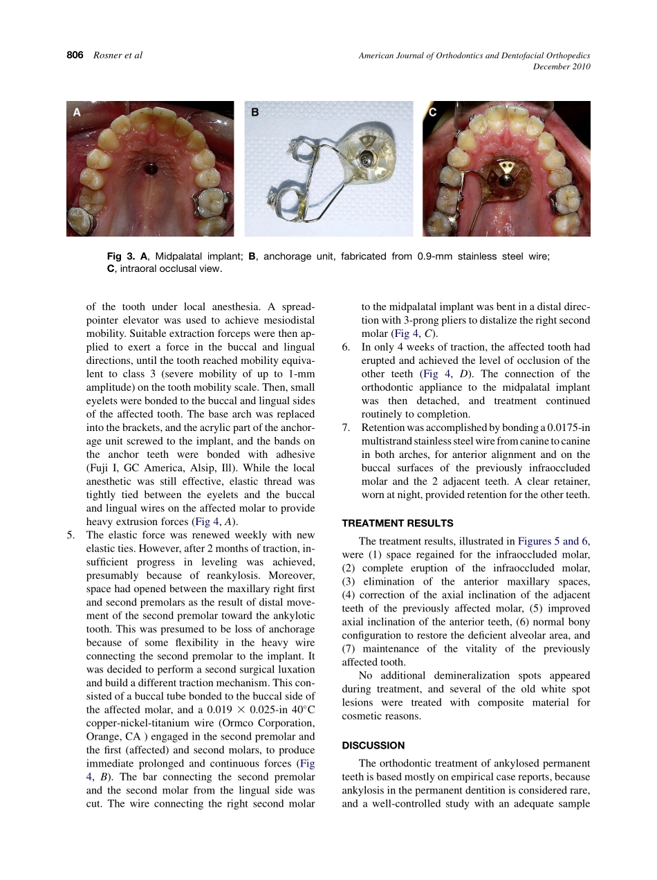 2010_138_6_804_809.pdf_第3页