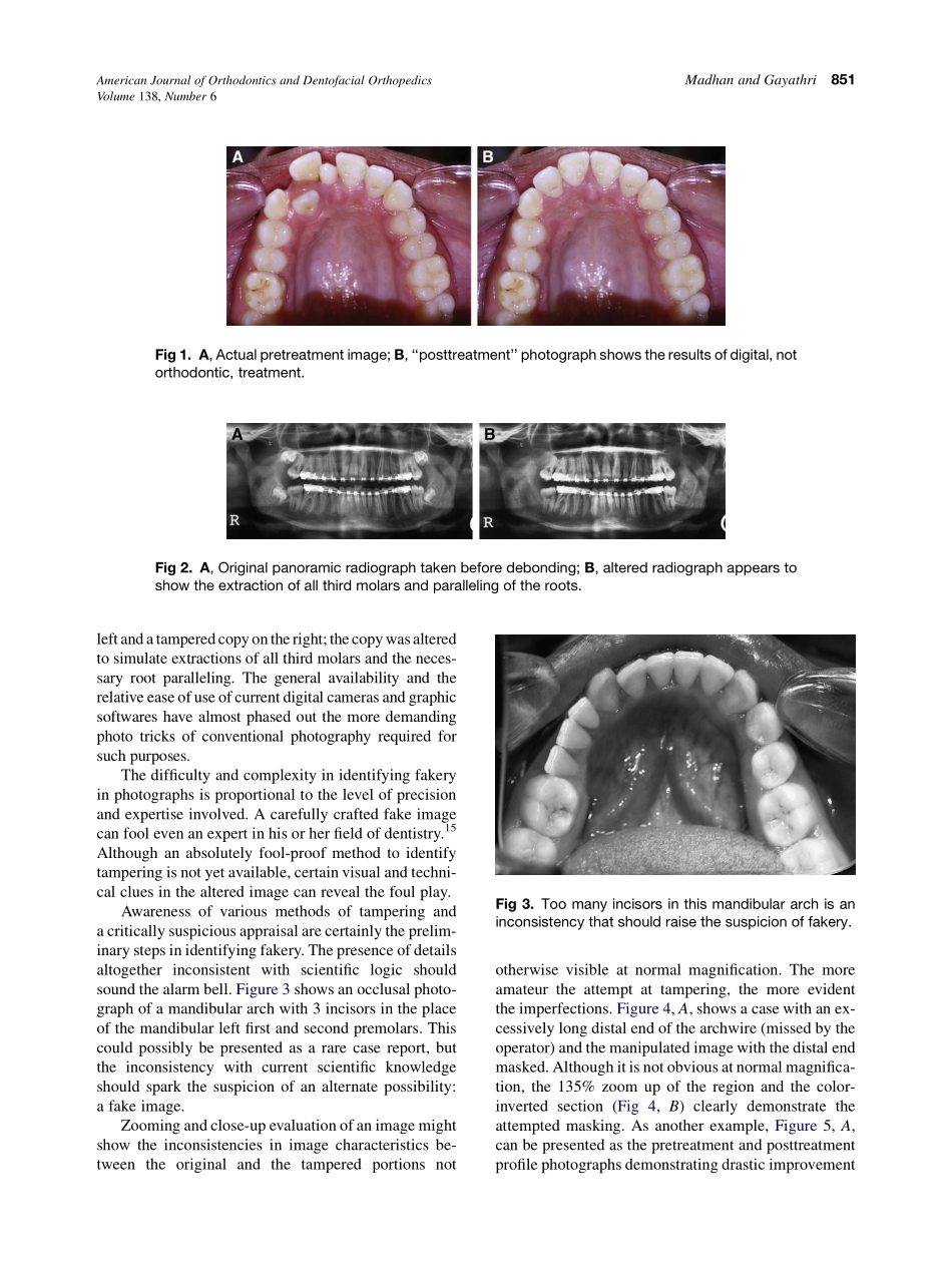 2010_138_6_850_857.pdf_第2页