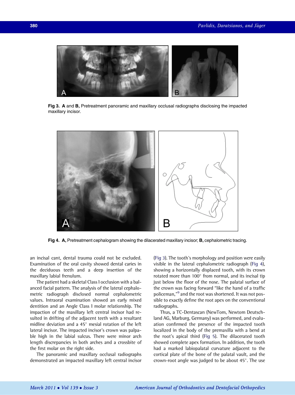 2011_139_3_378_387.pdf_第3页