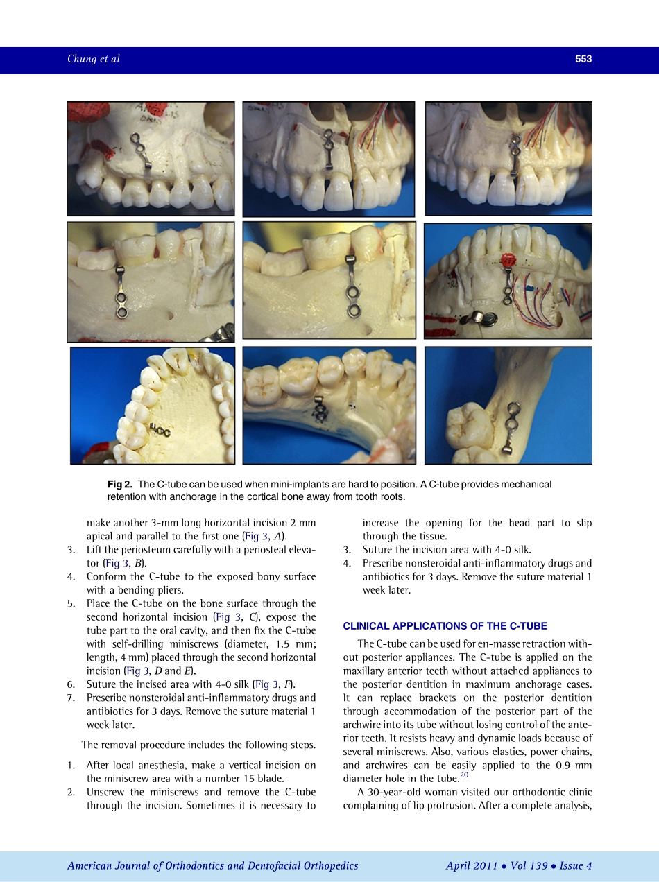 2011_139_4_551_562.pdf_第3页